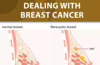 Dealing with Breast Cancer www.21e645788a.nxcli.net/Dealing with Breast Cancer; Early Detection and Management