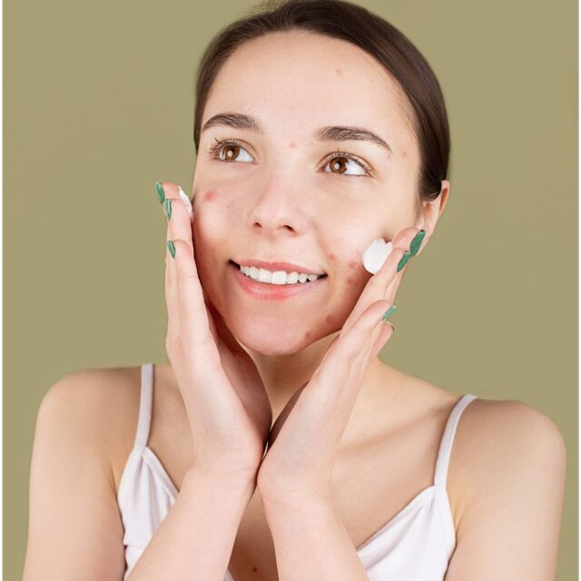 Facial Pimples Treatment Facial Pimples Treatment