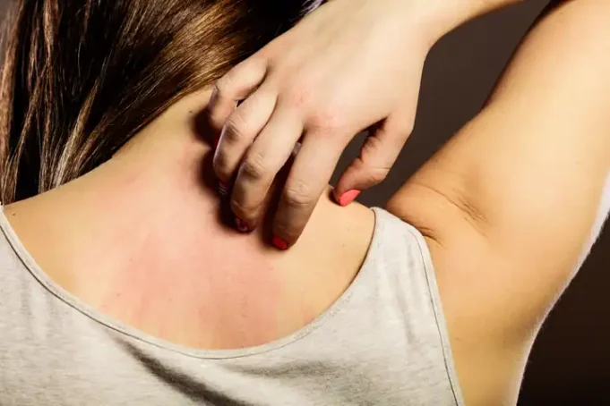 Itchy Skin After Shower No Rash. What to Do? Itchy Skin After Shower