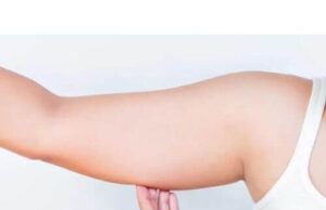 How To Lose Arm Fat Overnight Arm Fat