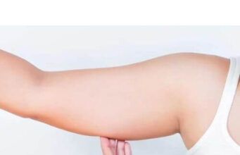 How To Lose Arm Fat Overnight Arm Fat