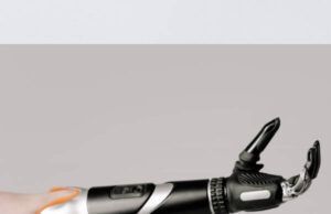 How Much Does Prosthetic Arm Cost Prosthetic Arm