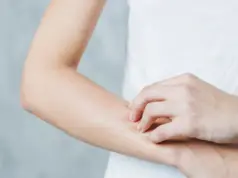 Can Chlamydia Cause Skin Rash? What To Do Can Chlamydia Cause Skin Rash