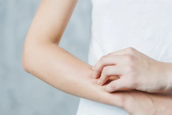 Can Chlamydia Cause Skin Rash? What To Do Can Chlamydia Cause Skin Rash