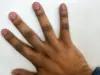 How To Lighten Dark Knuckles And Toes How To Lighten Dark Knuckles And Toes