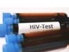 How to Test HIV at Home Naturally HIV test