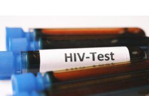 How to Test HIV at Home Naturally HIV test