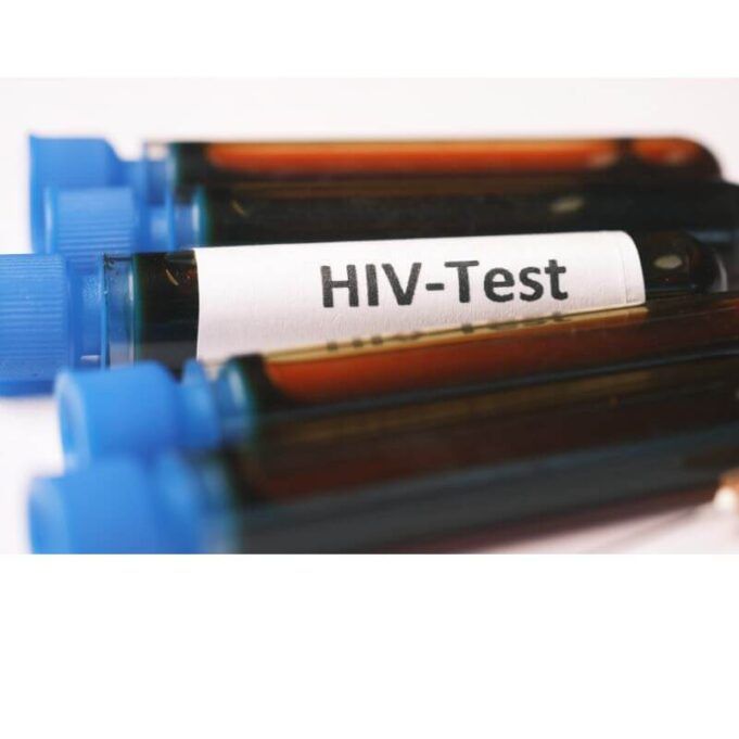 How to Test HIV at Home Naturally HIV test
