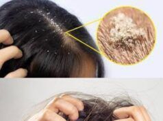 Home Remedies For Itchy Scalp Itchy Scalp