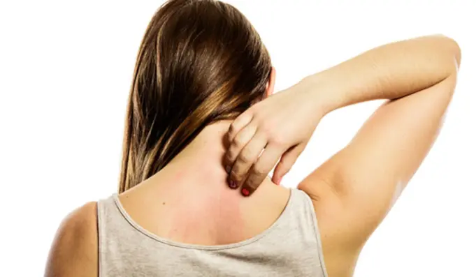 Best Home Treatment for Skin Rashes Best Home Treatment for Skin Rashes