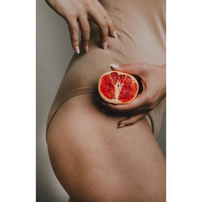 How to Remove Stretch Marks Permanently at Home Stretch Marks