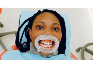 How To Remove Tartar From Teeth Without Dentist Teeth