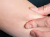 Itchy Skin After shower? What To Do