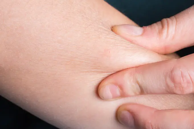Itchy Skin After shower? What To Do