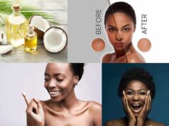 Benefits of Coconut Oil for Skin Whitening: A Natural Approach Coconut Oil for Skin Whitening
