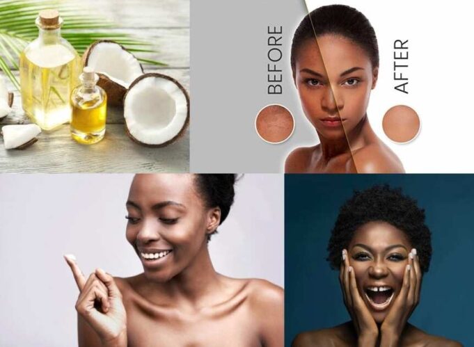 Benefits of Coconut Oil for Skin Whitening: A Natural Approach Coconut Oil for Skin Whitening
