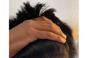 Hair Growth Cream For Receding Hairline Hair Growth Cream For Receding Hairline
