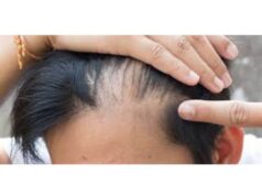 Hairline Fracture Recovery Time. Full Details Hairline Fracture Recovery
