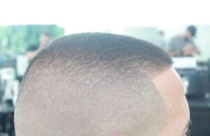 Hairstyles For Receding Hairline Black Male Hairstyles For Receding Hairline Black Male