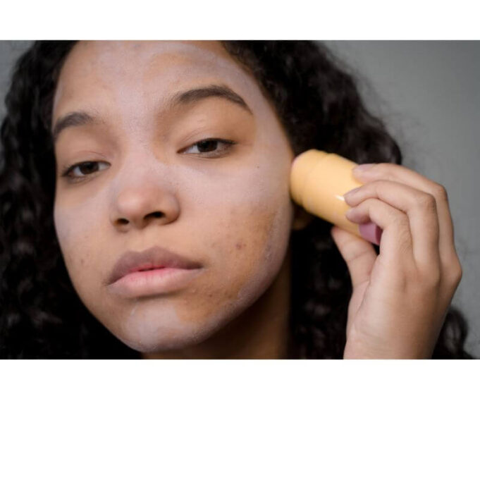 How To Treat Acne-Prone Oily Skin How To Treat Acne-Prone Oily Skin