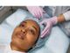 What do You Need to Know About Forehead Reduction Surgery? What do You Need to Know About Forehead Reduction Surgery?