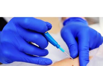 How Long Should You Keep a Skin Biopsy Covered How Long Should You Keep a Skin Biopsy Covered
