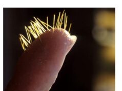 How To Get Tiny Cactus Needles Out Of Skin How To Get Tiny Cactus Needles Out Of Skin