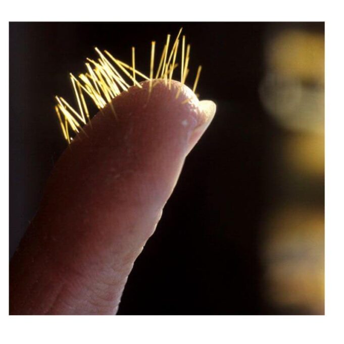 How To Get Tiny Cactus Needles Out Of Skin How To Get Tiny Cactus Needles Out Of Skin