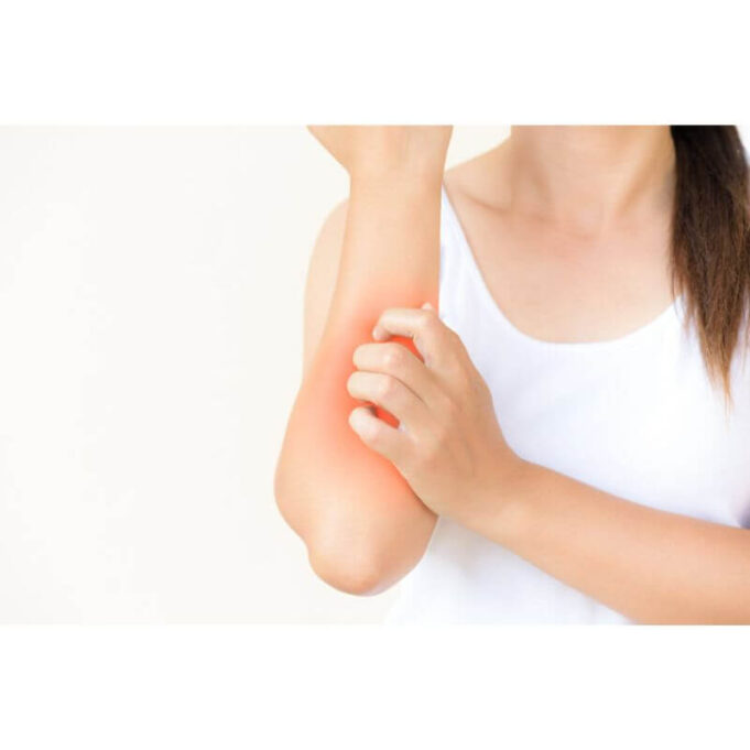 How to Stop Skin-Crawling Feeling Naturally How to Stop Skin-Crawling Feeling Naturally