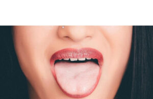 How to Stop Skin Peeling Inside Mouth How to Stop Skin Peeling Inside Mouth