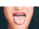 How to Stop Skin Peeling Inside Mouth How to Stop Skin Peeling Inside Mouth