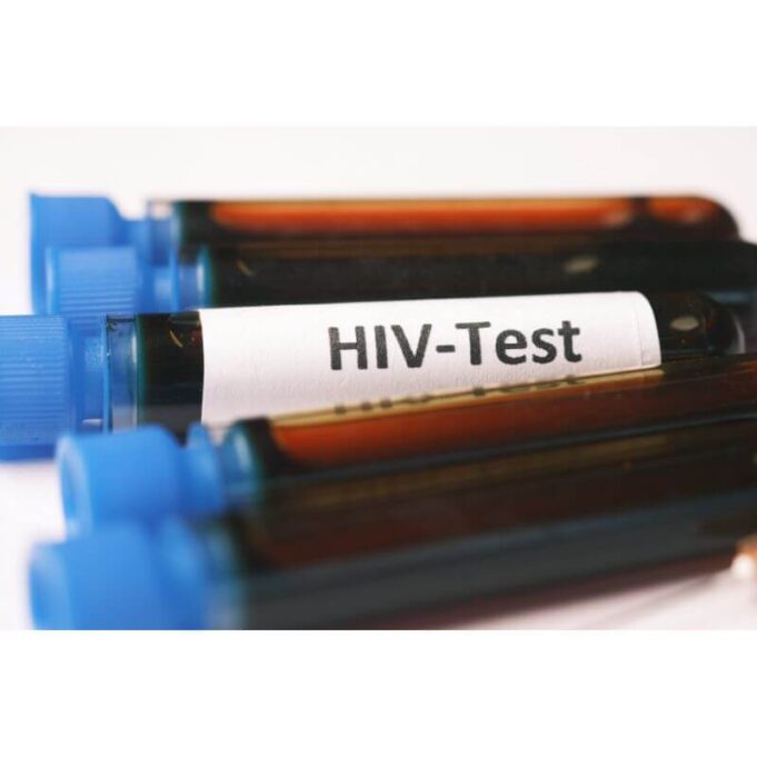 How to Test for HIV at Home Naturally How to Test for HIV at Home Naturally