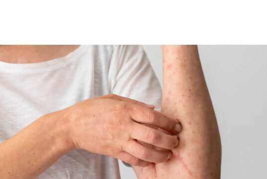Can Bleach Treat Fungal Skin Infections? Can Bleach Treat Fungal Skin Infections?