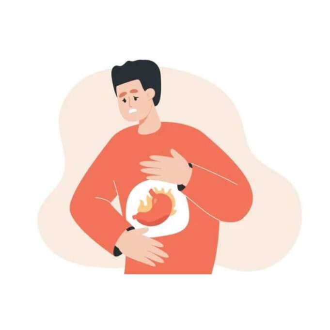 How to stop Heartburn How to stop Heartburn