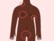 When Not to Worry about a Lump Under your Skin