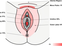 Arousal Syndrome Signs And Treatment Arousal Syndrome Signs And Treatment