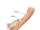 Tuberlin Skin Test Procedure Tuberlin Skin Test Procedure