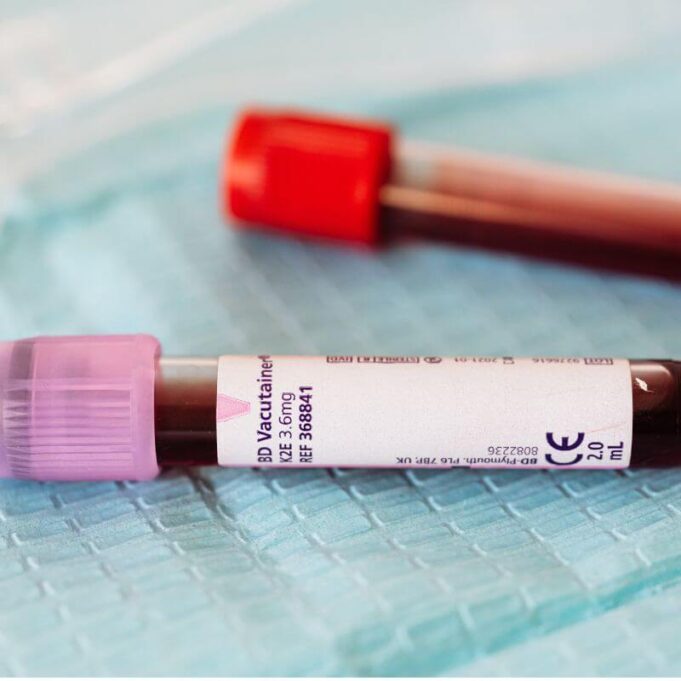 Blood Purifier for Skin: Everything You Need to Know Blood Purifier for Skin: Everything You Need to Know