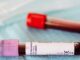 Blood Purifier for Skin: Everything You Need to Know Blood Purifier for Skin: Everything You Need to Know