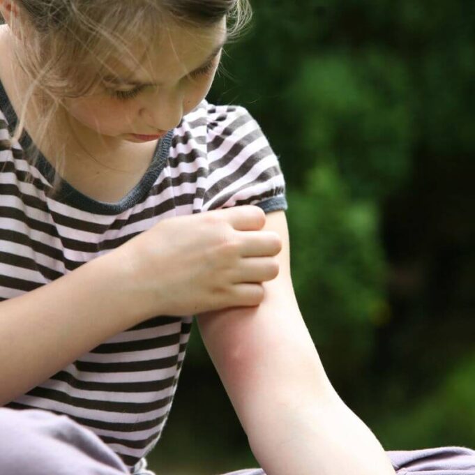 Do Mosquitoes Bite Through Clothes: Find Out Do Mosquito Bite Through Clothes