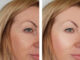 Tranexamic Acid for Skin: Everything You Need to Know Tranexamic Acid for Skin: Everything You Need to Know