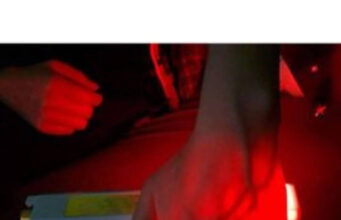 Vein Finder Price In Nigeria: Types and Full Details Vein Finder Price In Nigeria