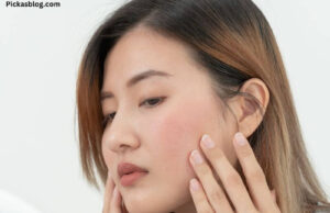 How to Cure Rashes on Face Naturally How to Cure Rashes on Face Naturally