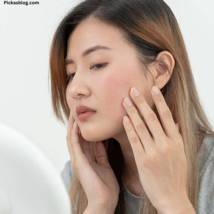How to Cure Rashes on Face Naturally How to Cure Rashes on Face Naturally