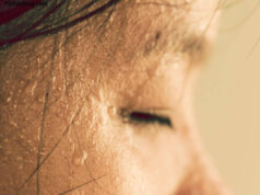 What Causes Excessive Sweating of the Head And Face What Causes Excessive Sweating of the Head And Face