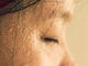 What Causes Excessive Sweating of the Head And Face What Causes Excessive Sweating of the Head And Face