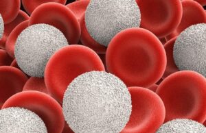 What Happens If White Blood Cells Are High What Happens If White Blood Cells Are High