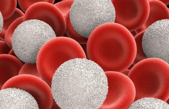 What Happens If White Blood Cells Are High What Happens If White Blood Cells Are High