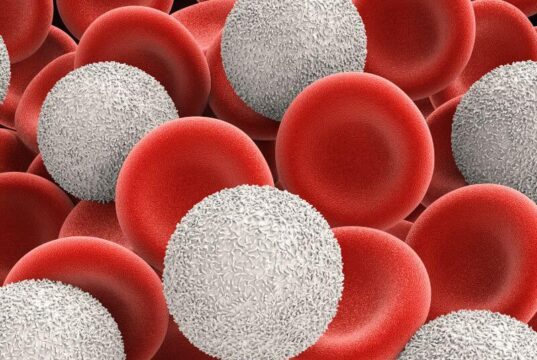 What Happens If White Blood Cells Are High What Happens If White Blood Cells Are High
