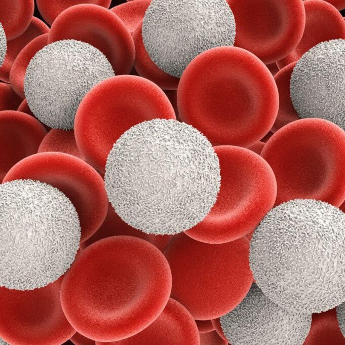 What Happens If White Blood Cells Are High What Happens If White Blood Cells Are High